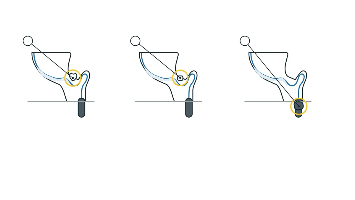 トイレの詰まりの3つの例。排水路の曲がりに紙が詰まる、固形物が詰まる、便器より先の排水管が詰まる